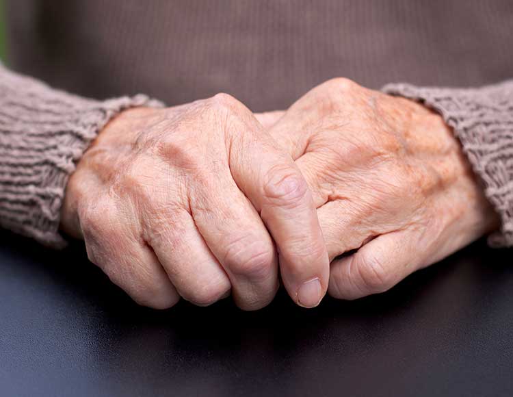 Mild cognitive impairment